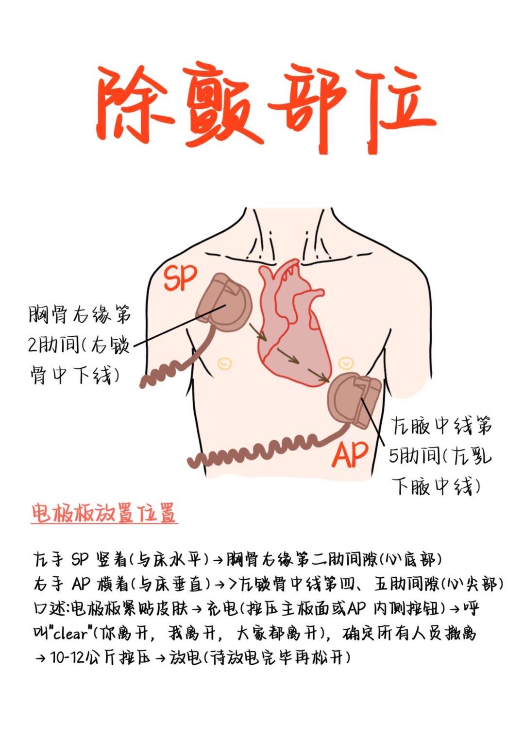 医学生笔记——除颤部位