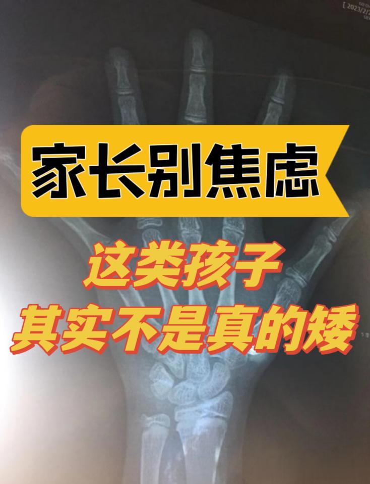 家长别焦虑！这类孩子其实不是真的矮！
 
经常收到家长的提问：孩子X岁了，身高X