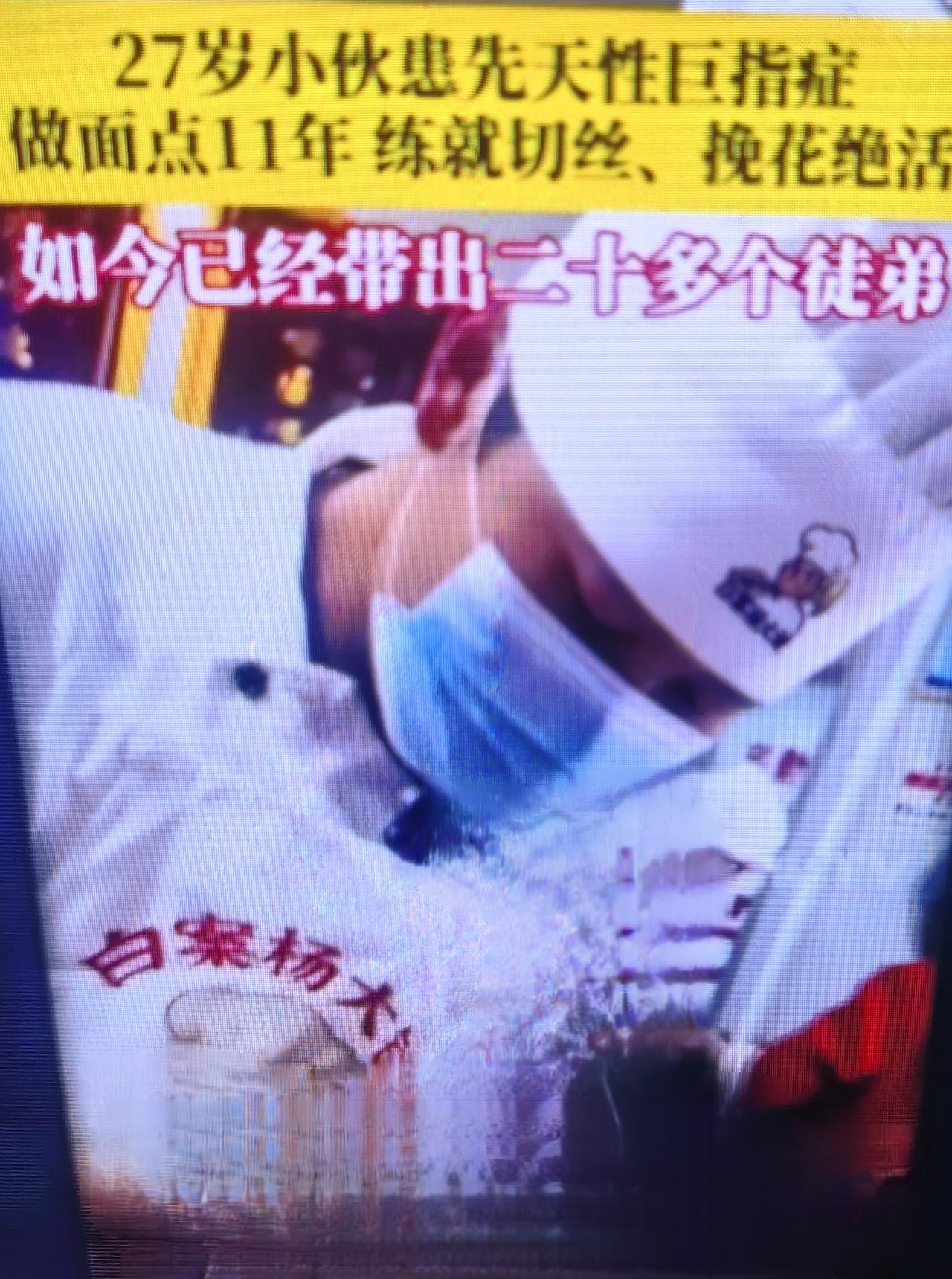 畸形右手练出“面点神功”，宜宾“杨大锤”的掌心开出花

在四川宜宾一家寻常的面点