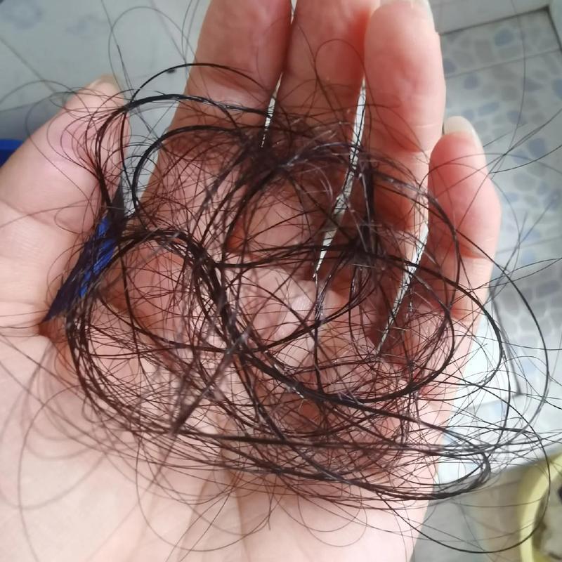 00后为什么也开始防脱了00后防脱焦虑蔓延？压力、熬夜、信息轰炸是诱因，但真不必