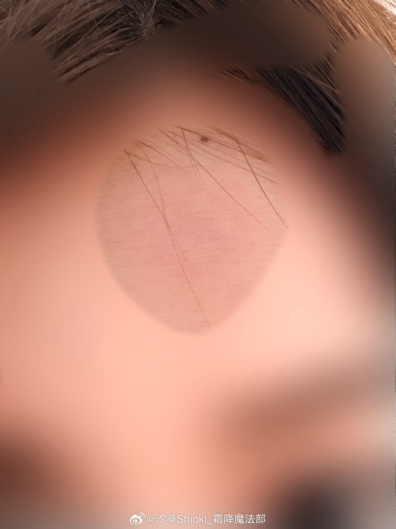 窝趣，给自己烫了好大一坨，疼鼠惹 