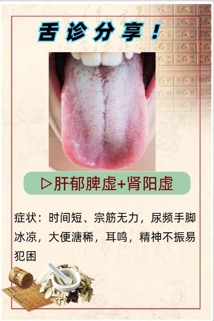 今日舌诊分享！

假期的舌苔全部辨证完了，给大家分享了几个较为典型的，今天继续给