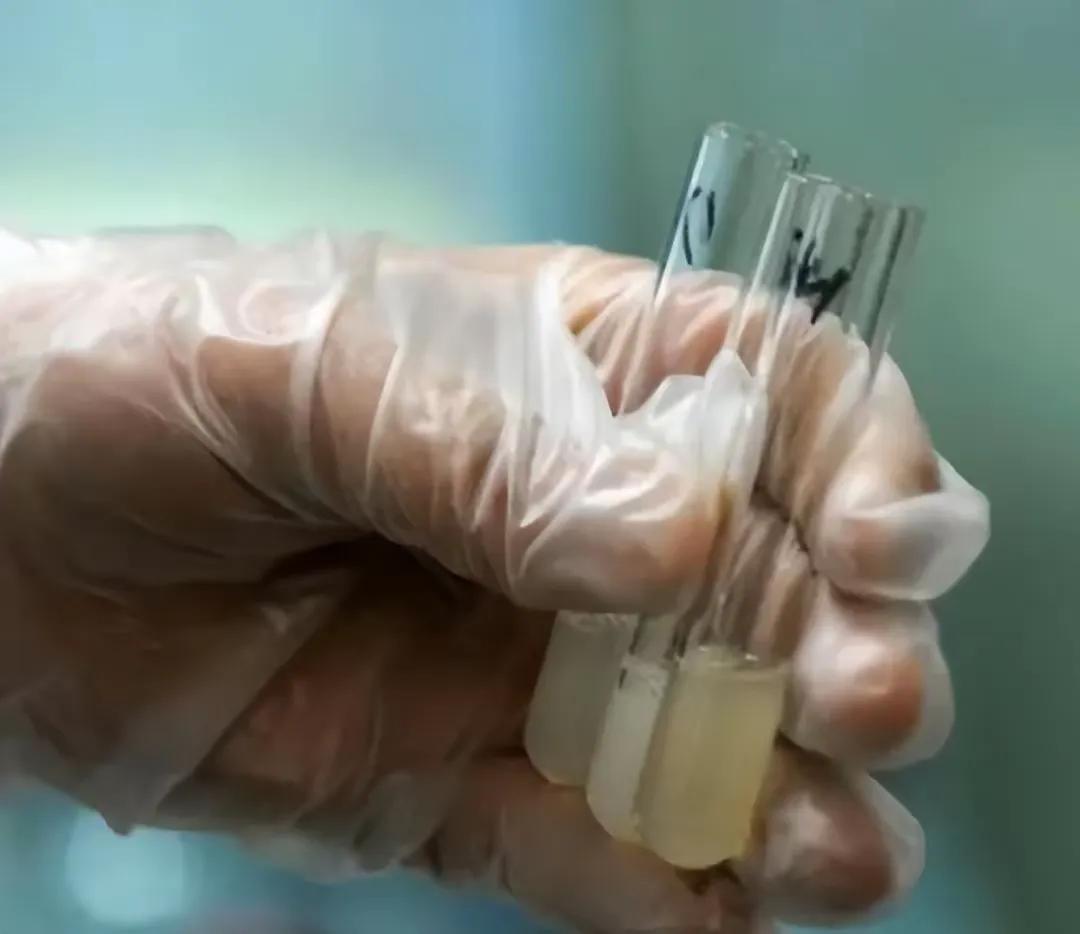 关于“精子库”工作的女护士单身率高的原因，可以从以下几个方面进行分析：
1.  