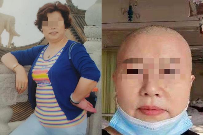 直到患癌离世，赵女士也没等到这场“酒店诉讼”的最终结果…… 赵女士是四川乐山商人