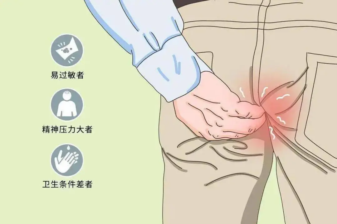 屁屁痒痒的？一文读懂肛周瘙痒
