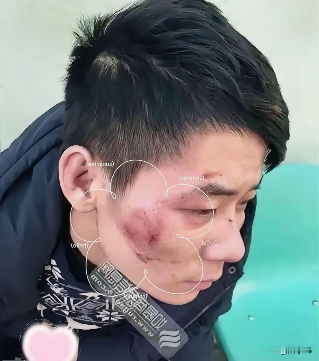 太猖狂了，一个男子深夜被6个醉酒的人追打，赶紧跑向武警营地，没想到在哨所门口，他