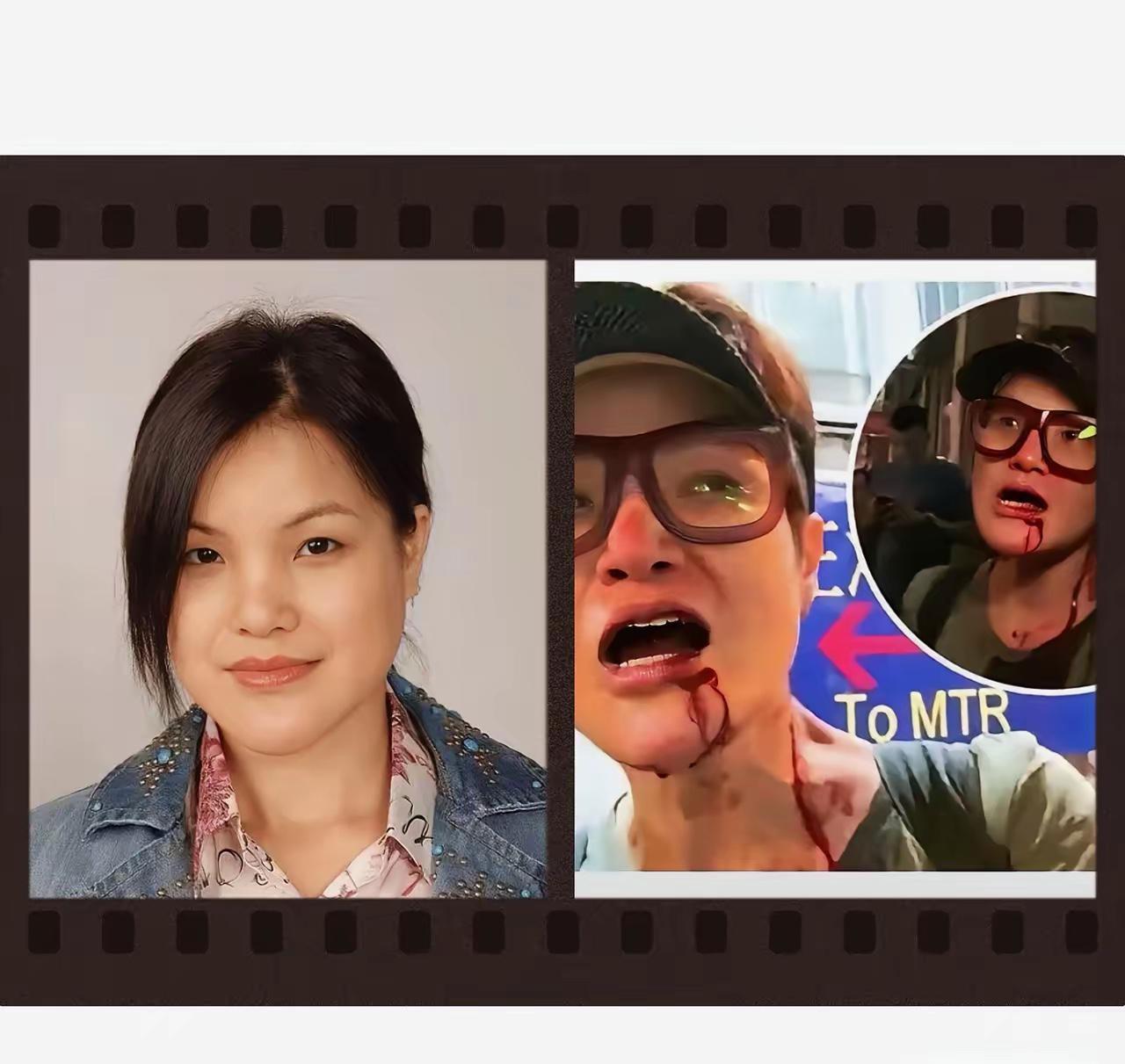 还记得当年香港“黑暴”闹得最凶的时候，马蹄露被打得头破血流的画面吗？

那时候的