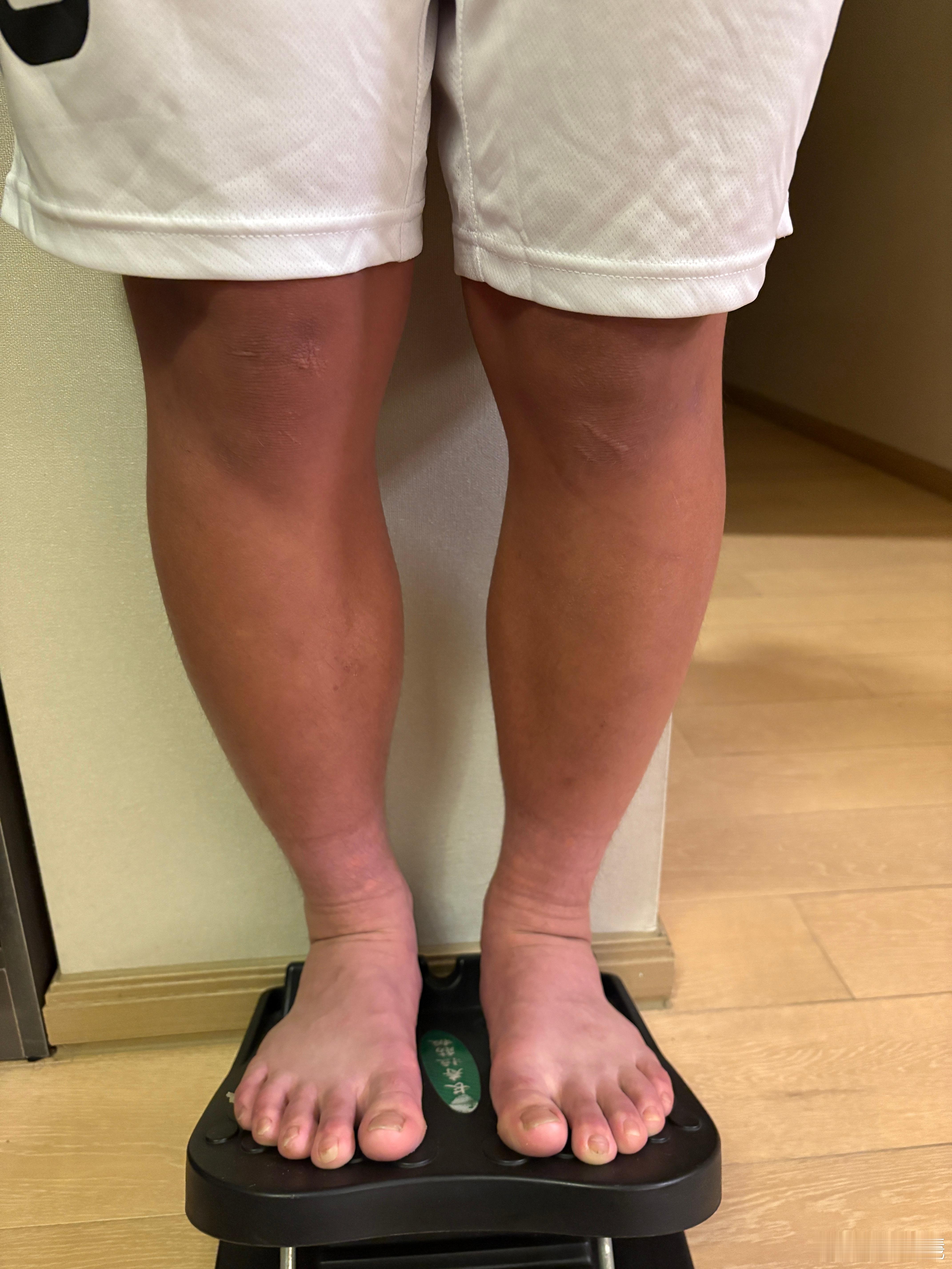 实在有点过于壮了，脚踝压力太大 