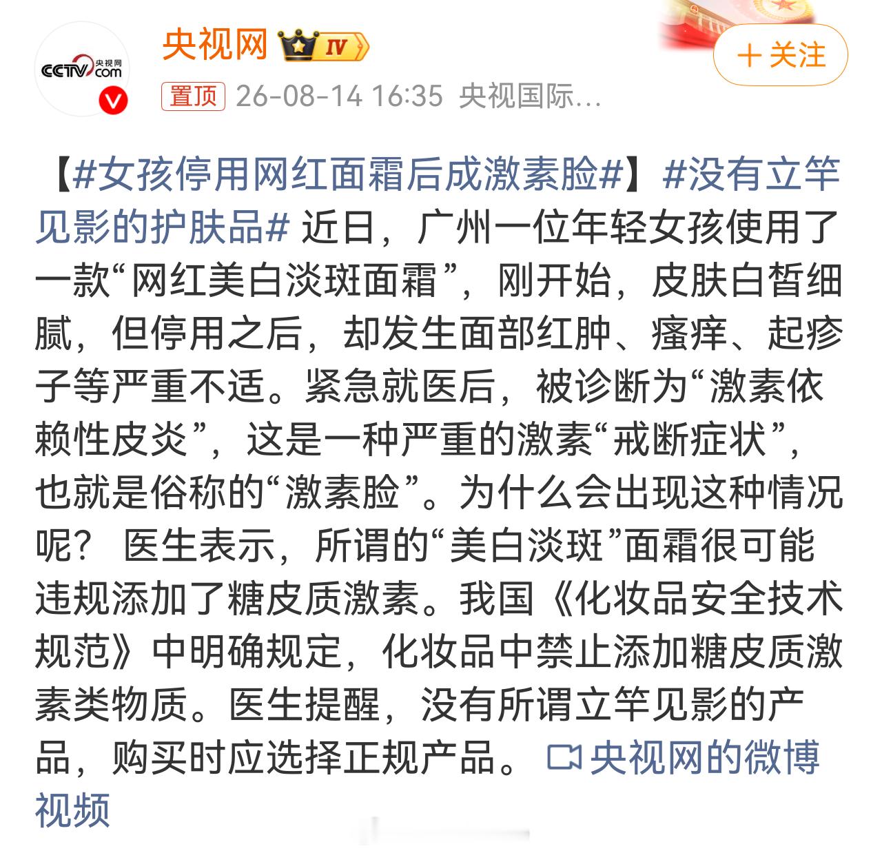 好家伙女孩停用网红面霜后成激素脸