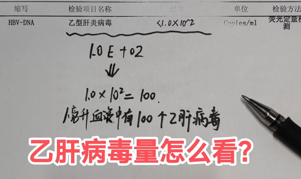 乙肝病毒量怎么看，今天讲清楚！
很多乙肝患者做完病毒DNA检查，不知道怎么看，今
