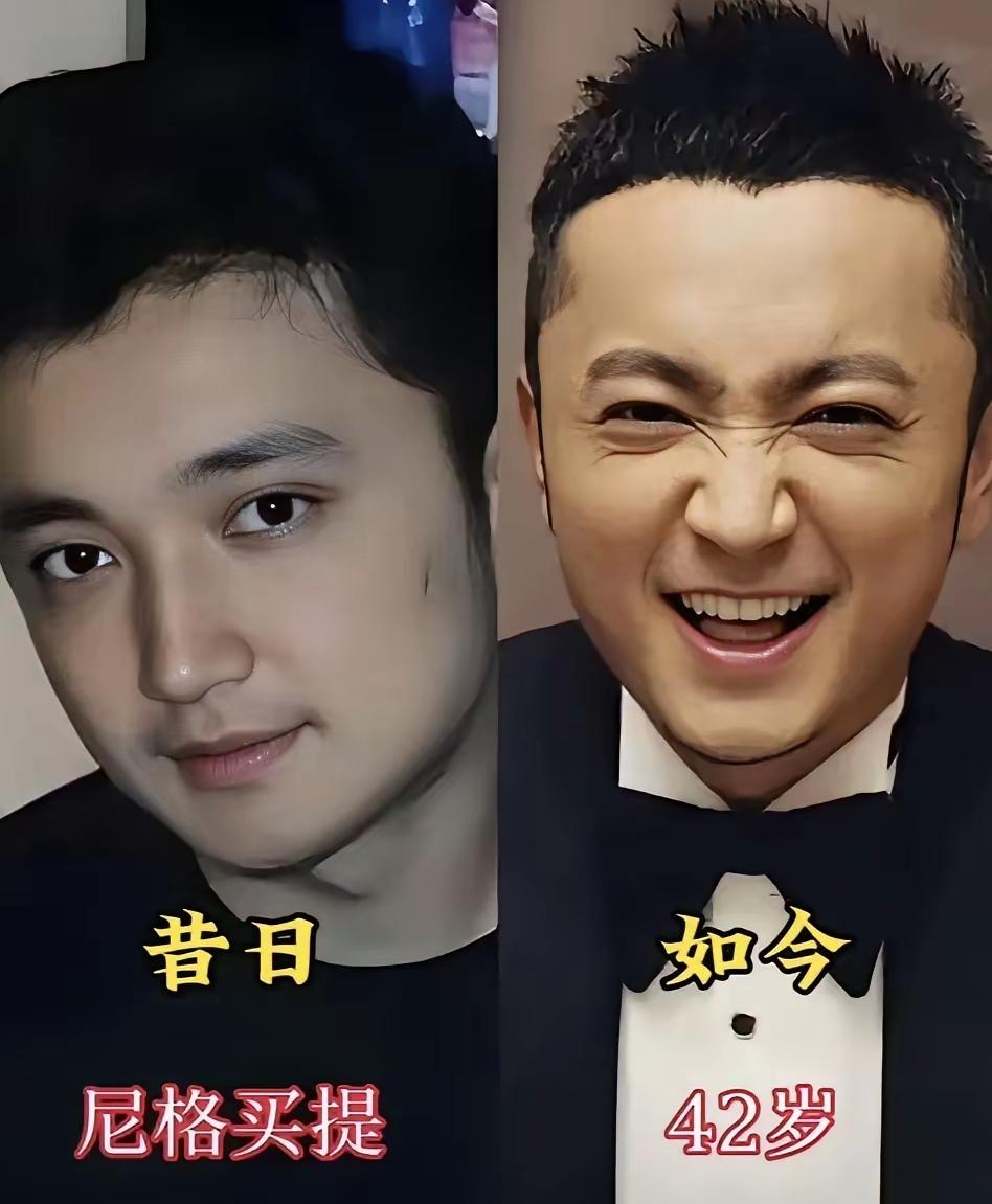 尼格买提出道前还是很帅气的，新疆人那种五官立体深邃有型，浓眉大眼，剑眉星目，高挺