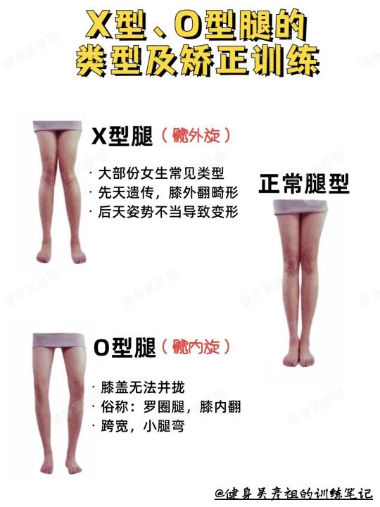 腿型改善 | 30s自测你的腿型！附矫正训练