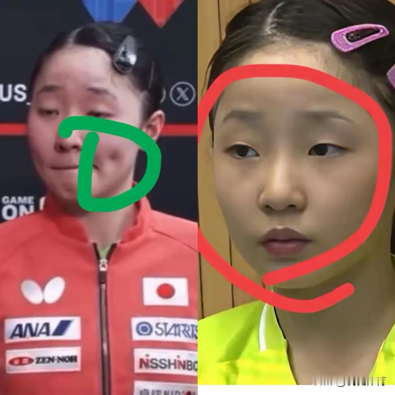 张本美和，酒窝特别吸睛，我一直以为酒窝是天生自带的。
看到她小时候视频照片才发现
