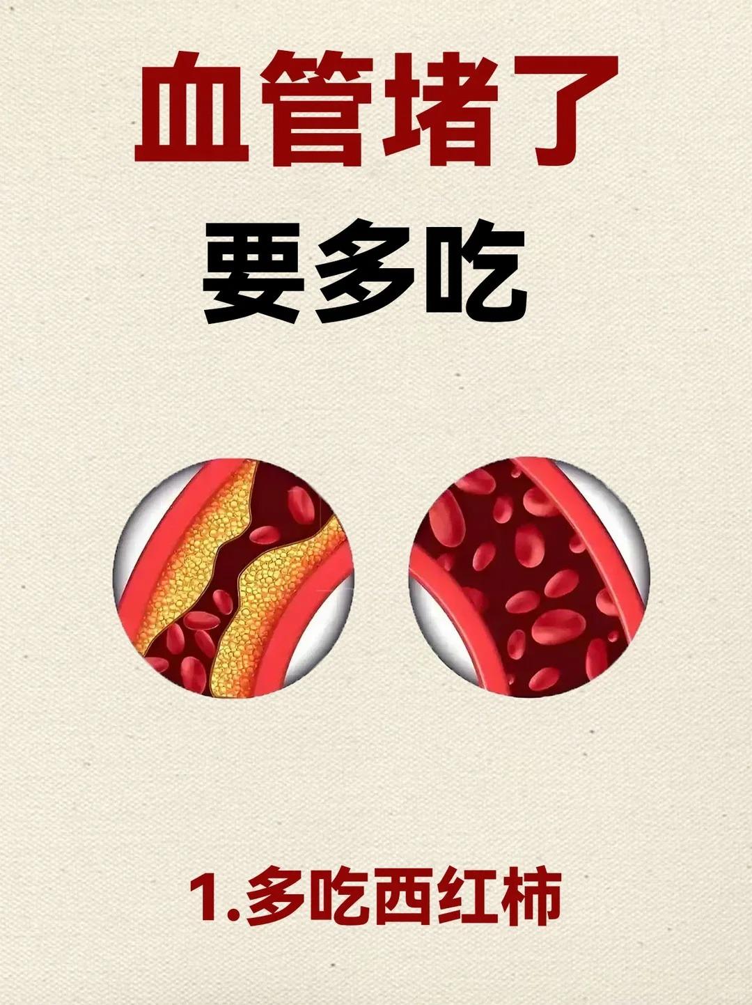 快存！这几样家常菜就是天然血管清道夫。久坐不动、爱吃油腻、经常头晕手麻...
