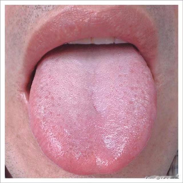舌头上的红点点也有大作用，所代表的意思你知道吗？

大家早上起来刷牙照镜子的时候