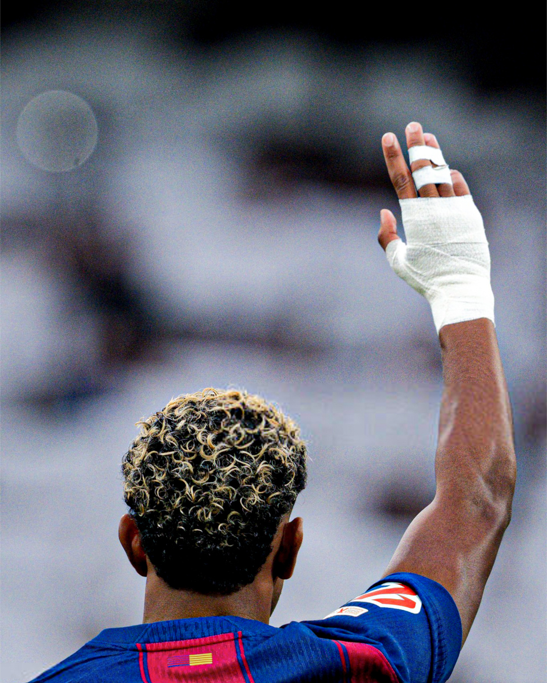 塞尔电台：在巴塞罗那，他们确认亚马尔的耻骨疼痛几乎完全消失，但他的状态可能还没有