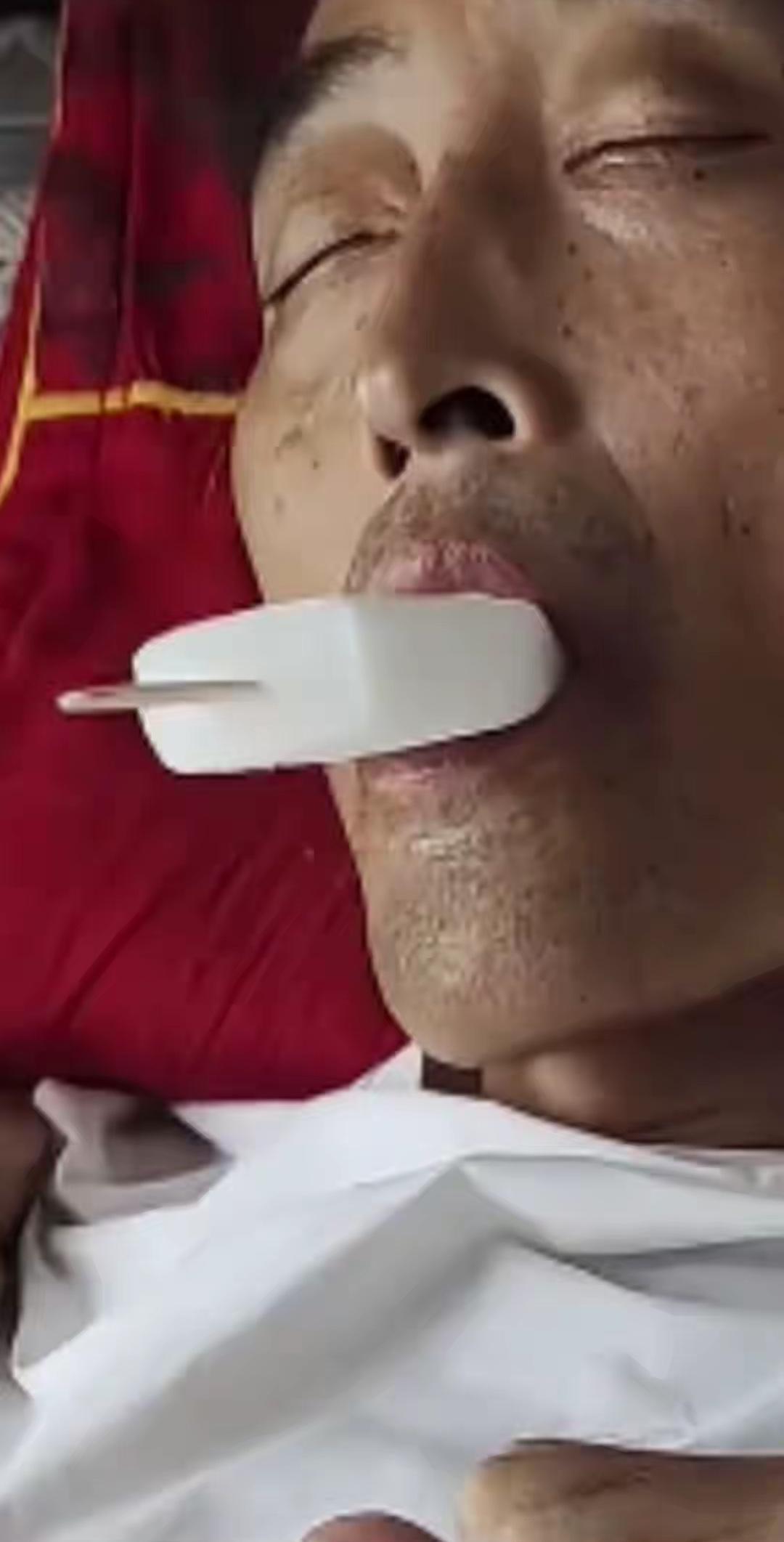 泪酸，丈夫得胃癌晚期，五天没吃饭，说胃痛的难受，不想吃，靠营养针活着，最后给妻子
