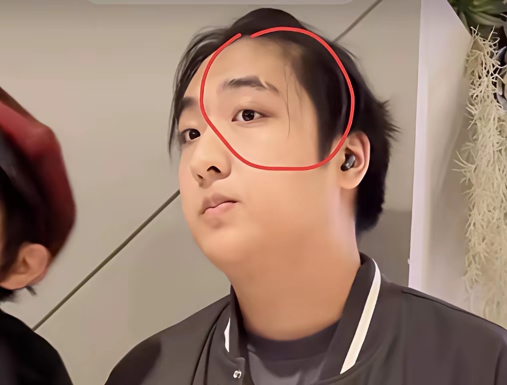 看到费曼脸上巨大的伤疤，感觉当年吴镇宇怒摔话筒算轻的了。 