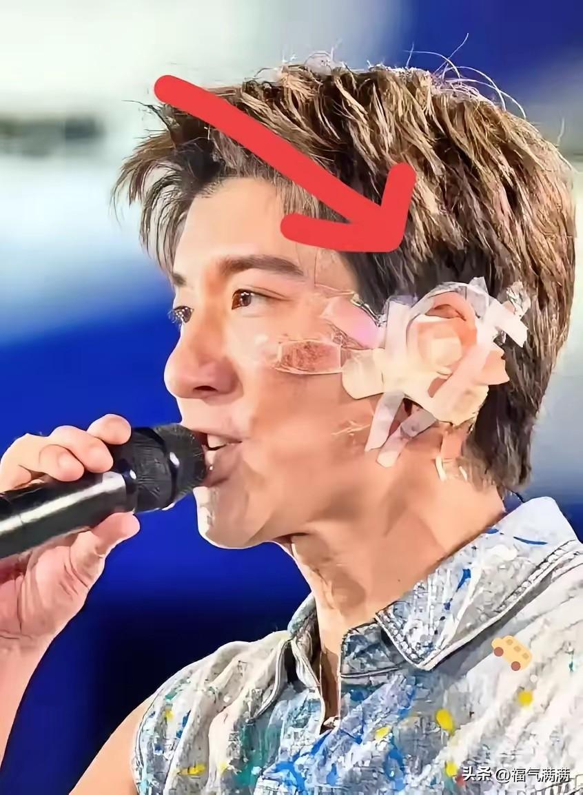 看见没？以后演唱会得先过安检，
排查钢丝和台阶！
王力宏这次摔得可不轻，耳朵直接