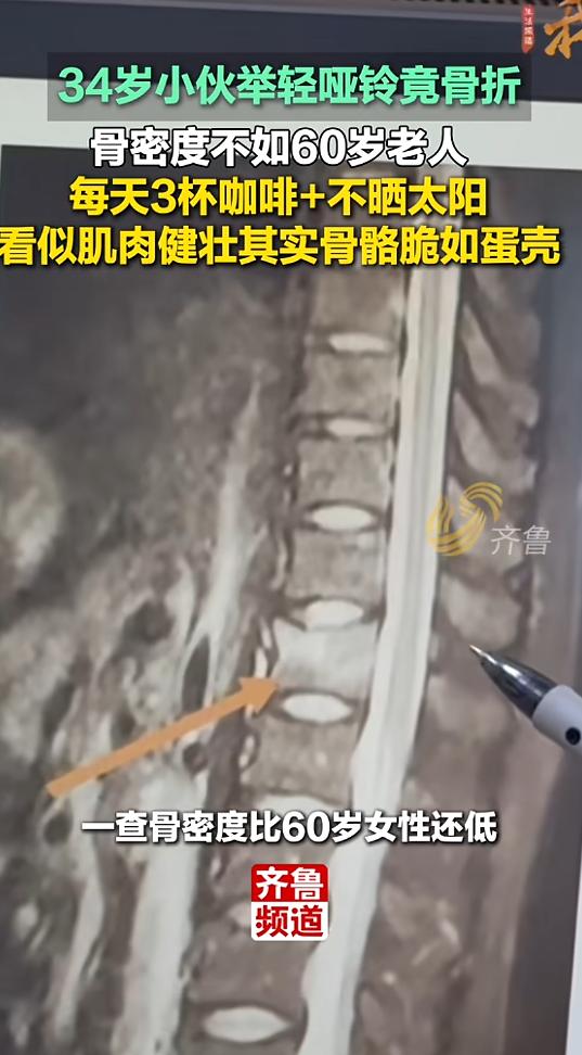 34岁的李先生，在浙江做室内设计工作，平时最大的爱好就是健身，几乎每天下班都会泡