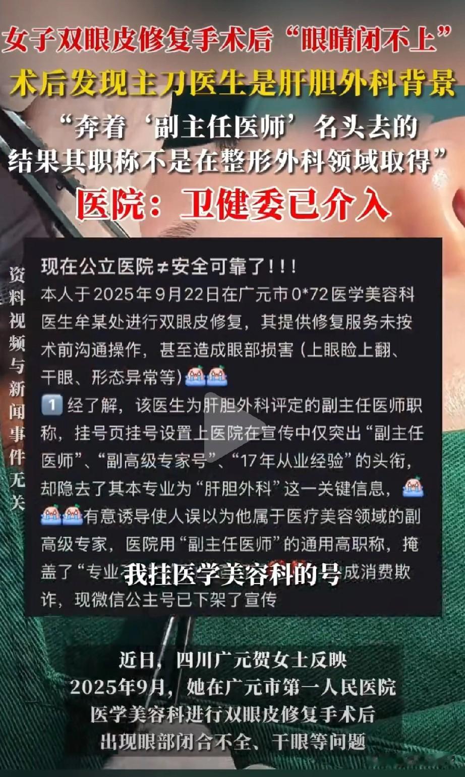 四川广元一名女子在公立三甲医院接受双眼皮修复手术后，因主刀医生实际为肝胆外科专业