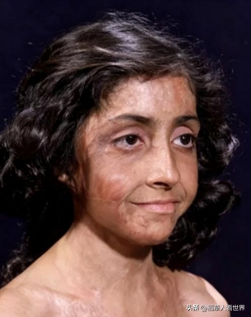 阿富汗一个女孩的因为意外，差点毁掉人生，但来自全世界的善意，最终帮她逆天改命。