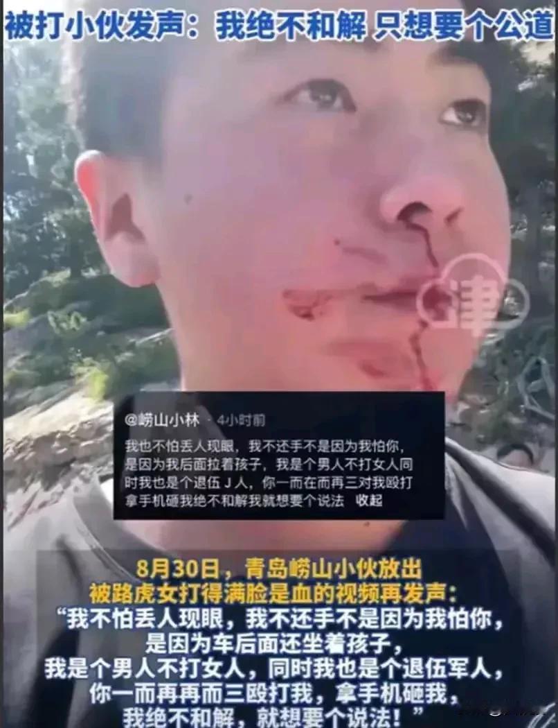 打成这样
1000块钱？[恐惧][恐惧][恐惧]
如果是你
被路虎女司机揍成这样