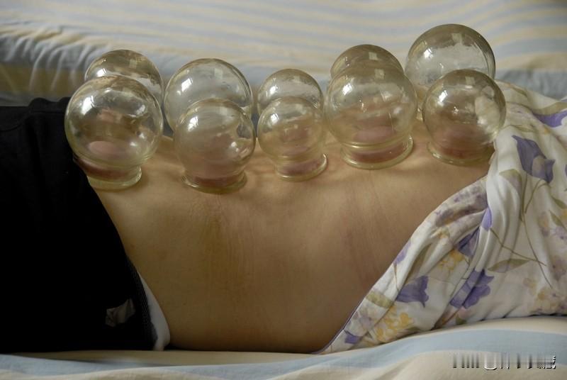 肩周炎治疗没有副作用的方法是什么治疗肩周炎没有副作用的方法，西医手术首先排除。目