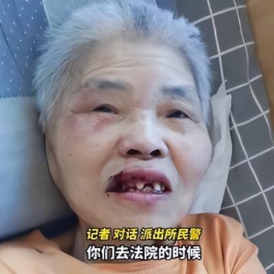 武汉一家养老院，一个完全瘫痪在床、连翻身都做不到无任何自救能力的八旬老人，半夜被