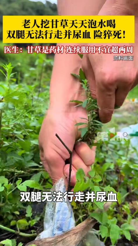 “别再乱拿野甘草泡水养生了！”西安一位老人天天喝自制野甘草水，短短两个月双腿肿成