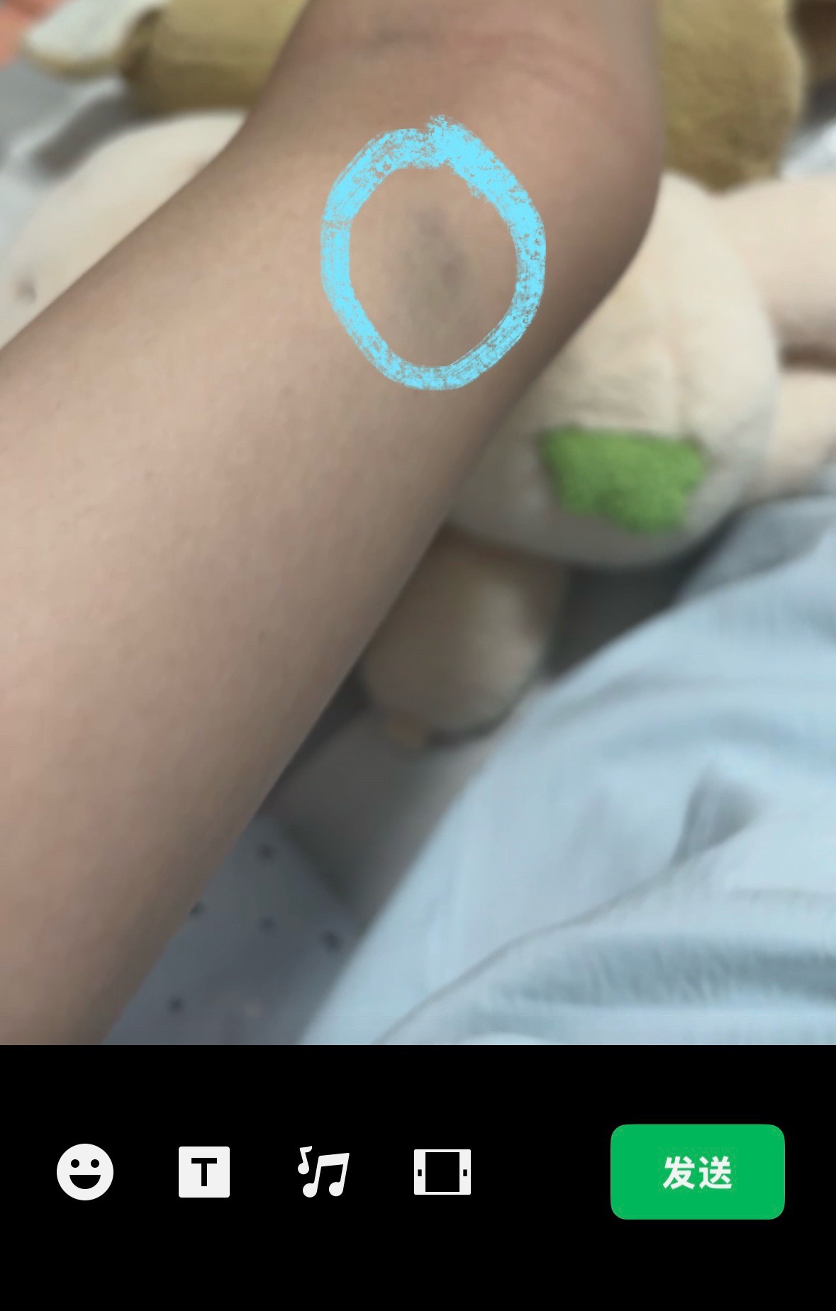 我是睡觉的时候给我自己掐了一把吗 ​​​