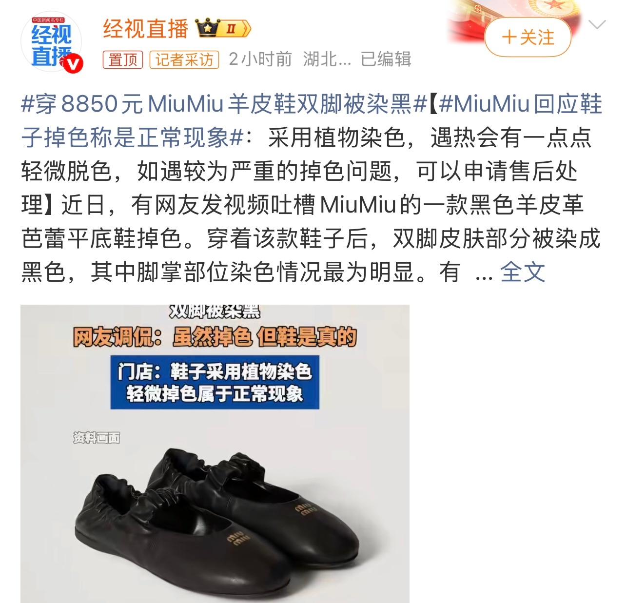 穿8850元MiuMiu羊皮鞋双脚被染黑价格是不便宜啊。有点不理解，为啥是这样。