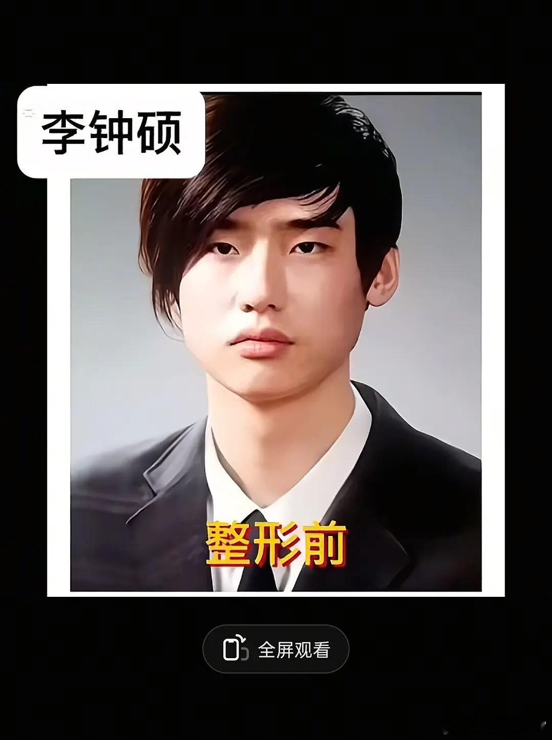 欧巴，原来你们都是整过的