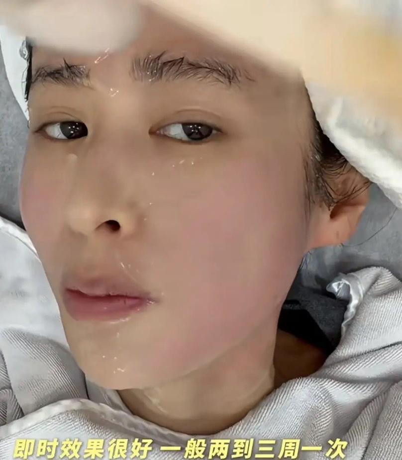 【颖儿10万“换脸”，暴露娱乐圈抗衰赛道的血腥内卷！
】
这根本不是美容，这是一