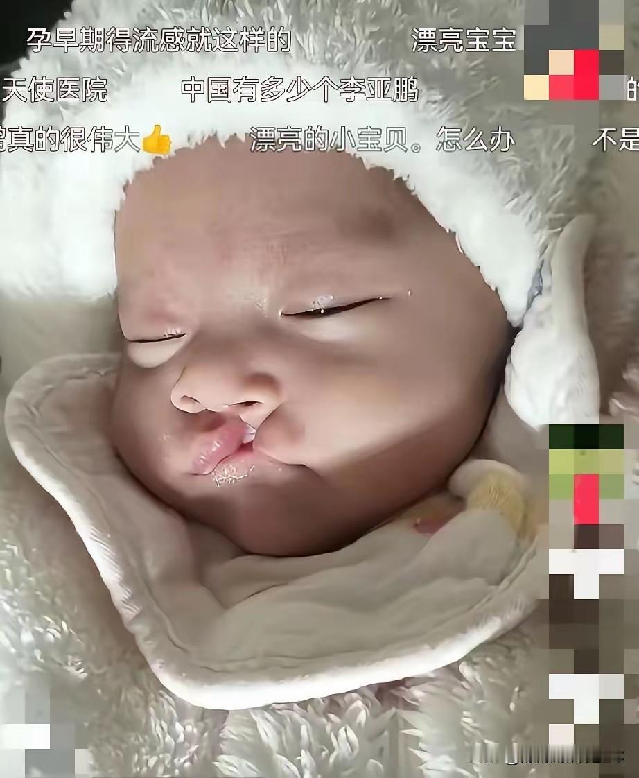 李亚鹏这回是真的没得黑，办事儿太利索了。

我是无意间看到那个唇裂幼童视频的，底