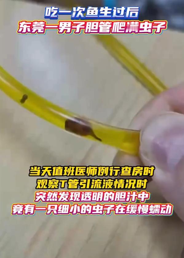 40岁男子吃一次淡水鱼生，胆管里竟爬满活虫，
刘先生因为半年前吃了顿淡水鱼生，医