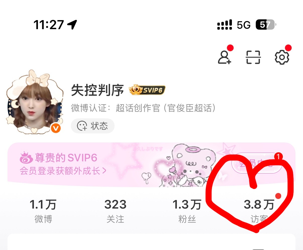 你这样我会紧张的 