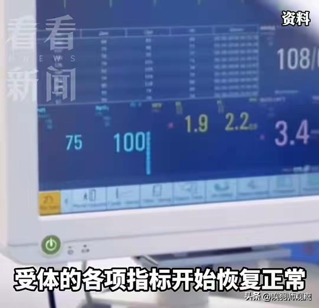近日，广西医疗团队成功将基因编辑猪的完整肝脏和两颗肾脏，同时移植到一名53岁脑死