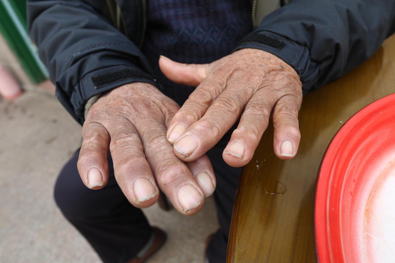 手指长寿命长？调查发现：活过85岁的老人，手上都有这3个特征 
 
伸出自己的手