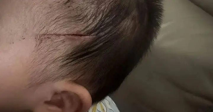 五旬男子在合伙人家中身中数刀死亡，11个月大婴儿头部被砍伤，17岁少年被刑拘