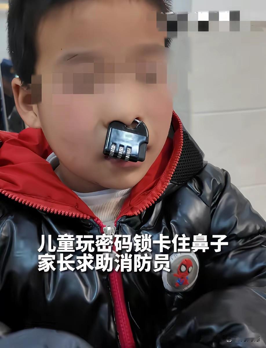 这孩子也太淘气了，把密码锁卡在了鼻子上，如果没有消防队员帮忙的话，真不好取下来，