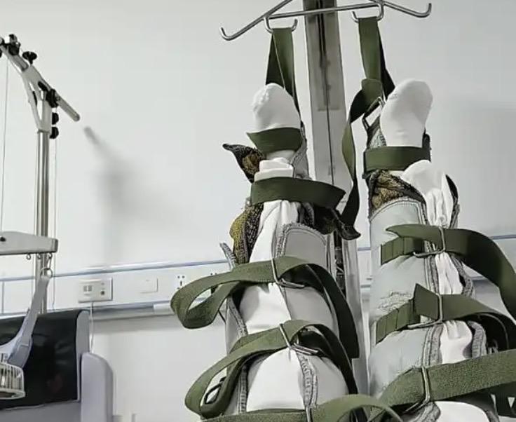 女子在医院做牵引，双腿被吊一个多小时无人管，事后医院一句计时器坏了给忘了，就能免