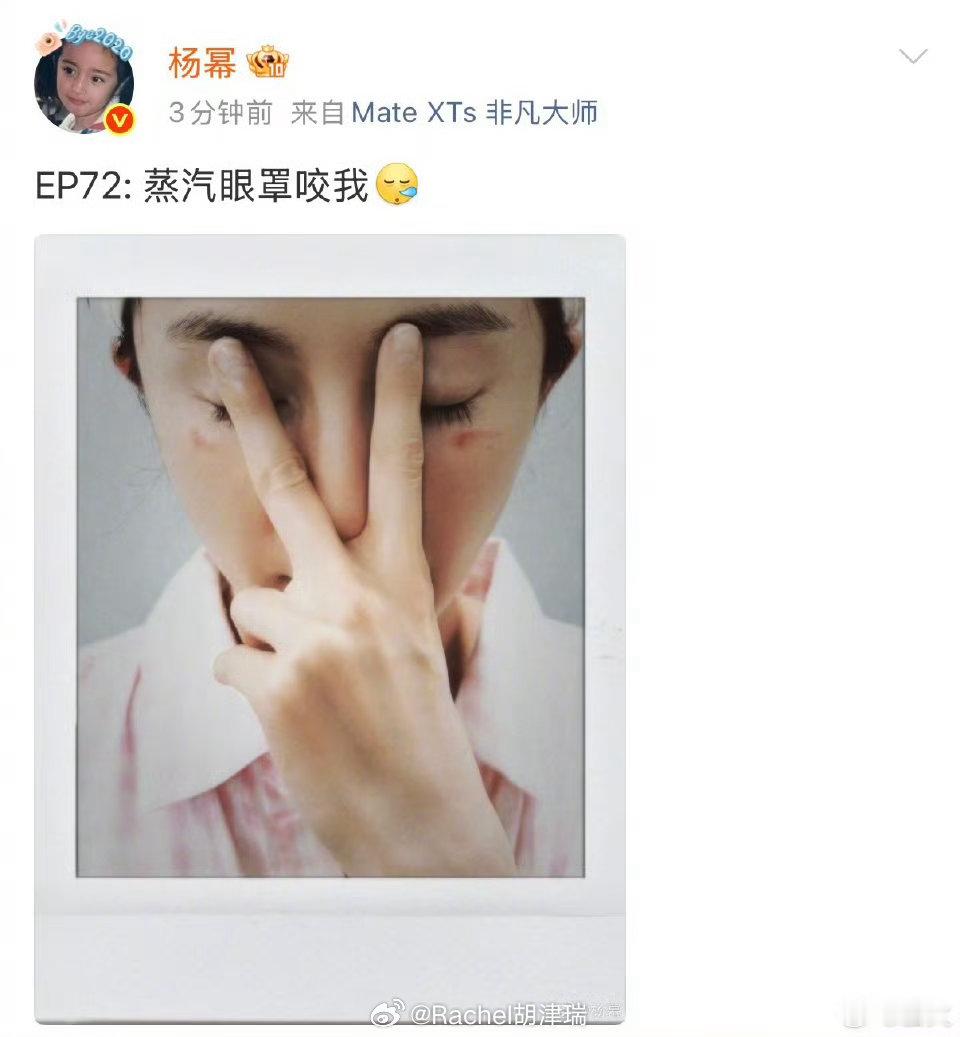 杨幂脸被蒸汽眼罩烫伤了眼周皮肤本来就娇嫩脆弱，千万不要戴着过夜、长时间敷用日常舒