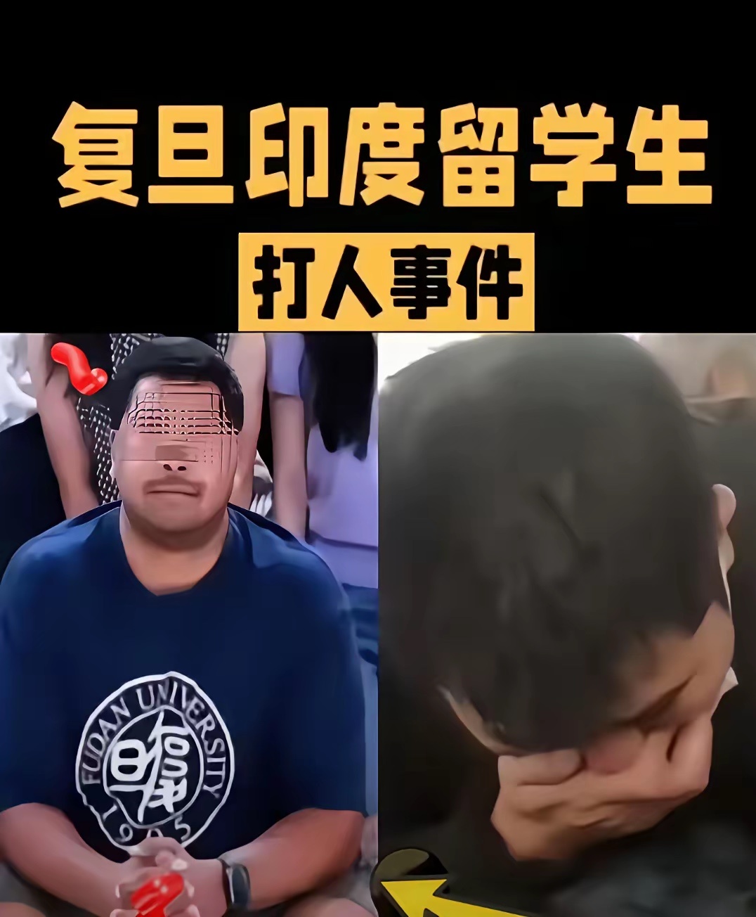 复旦这回又上热搜了，看得人心里真不是滋味。校内学生被外籍留学生打了，报警验伤都有