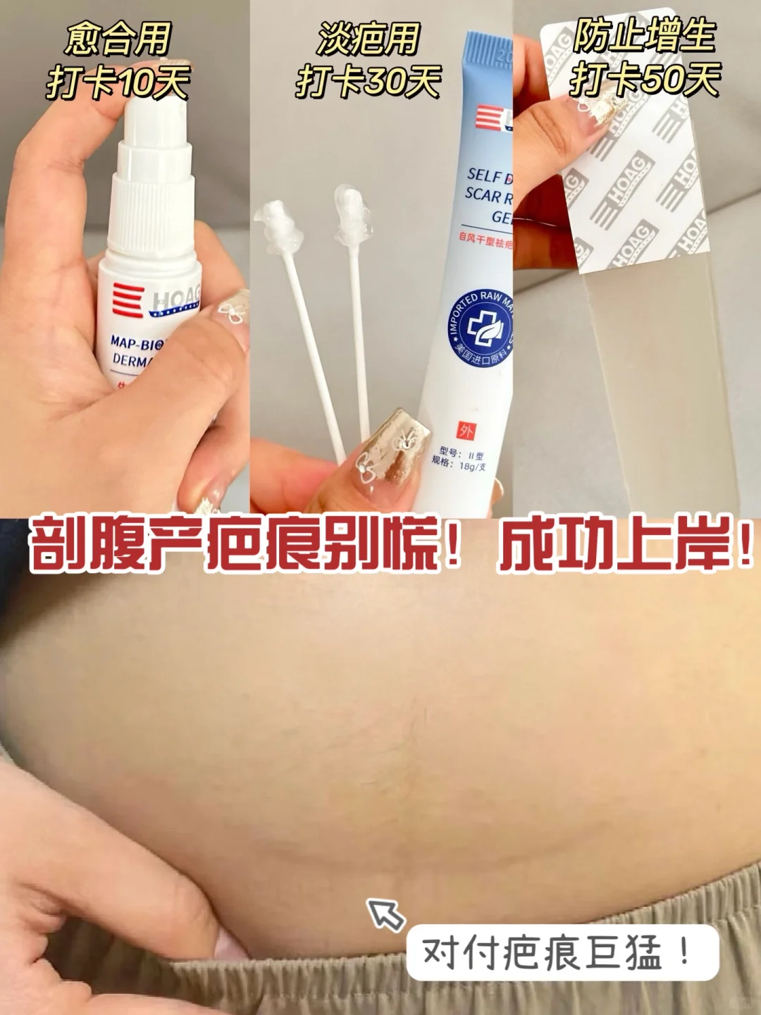 记得刚生完孩子那会我挺抑郁的…. 因为挨一刀就算了，还留着疤痕 稍不注...