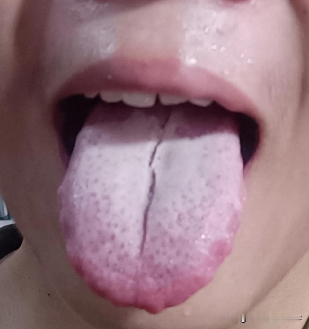 小兄弟，你这舌头可不是补肾那么简单，管不住手，啥都白搭！

刚二十出头一小伙子，