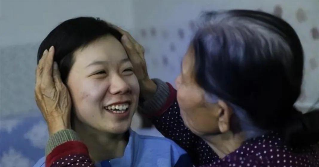 她因手臂残疾被父母抛弃，58岁拾荒妇人见其可怜，58岁拾荒妇人见其可怜捡回家用面