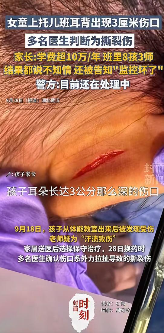 最担心的事情还是发生了！

女童上十万一年的托儿班，回家后耳背上竟出现3厘米伤口