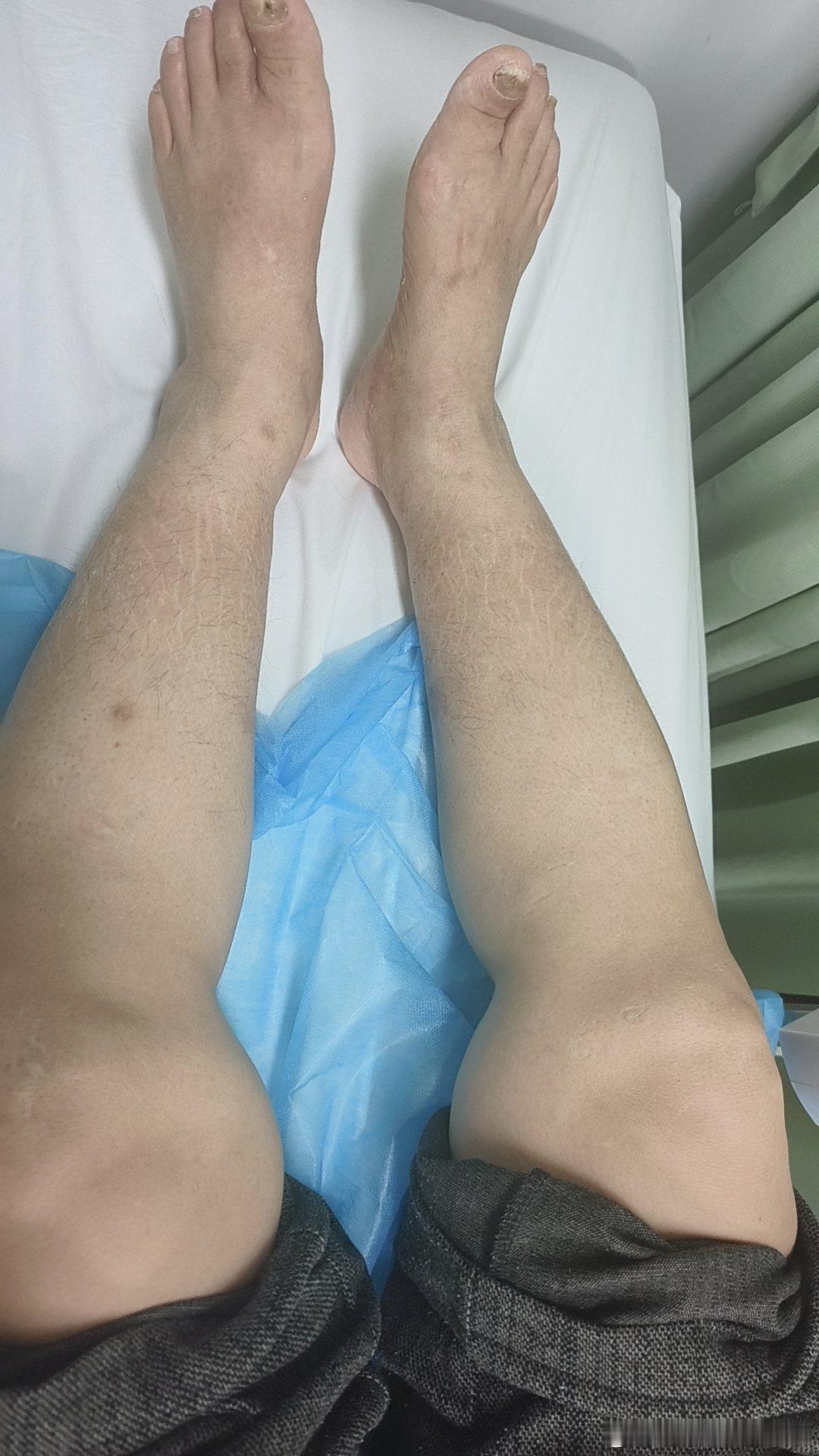 年纪大的人不容易，尤其是过去体力劳动的，膝关节疼，各种关节疼，受凉风，占凉水就疼