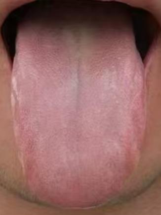 中年体虚易乏力？根源多在心肾不交，养心益肾方能稳步调理






有一部分中年